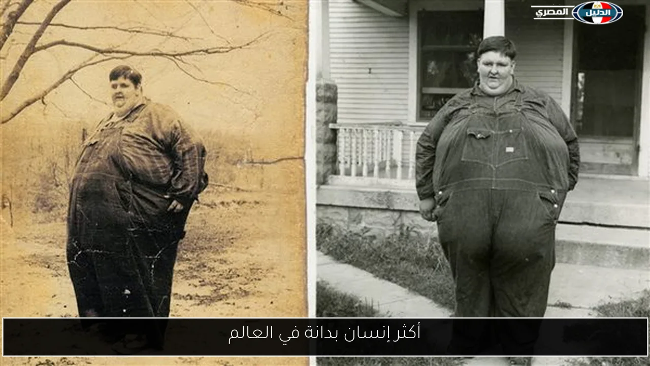أكثر إنسان بدانة في العالم