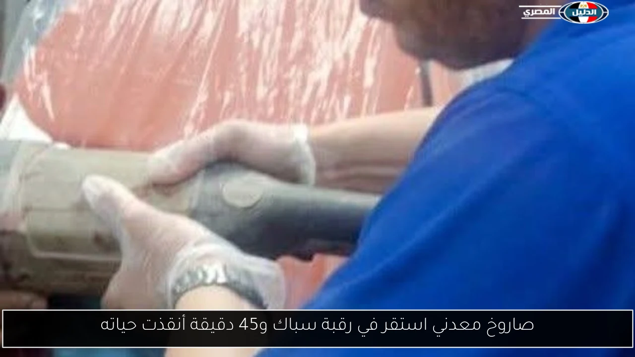 صاروخ معدني استقر في رقبة سباك و45 دقيقة أنقذت حياته